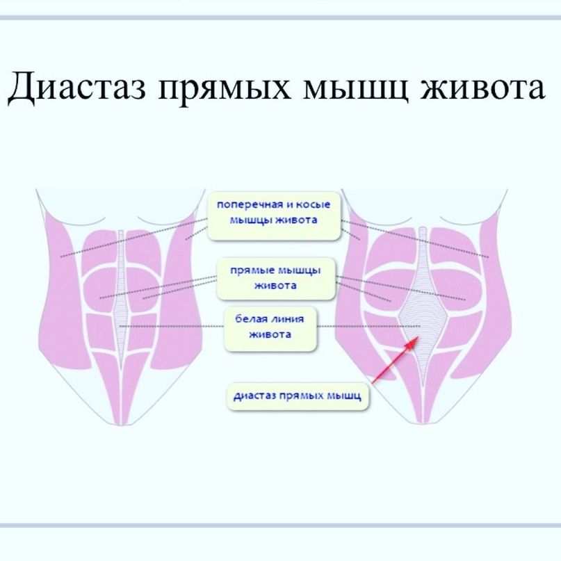 Диастаз! Закачивать нельзя оставить… Где поставим запятую?