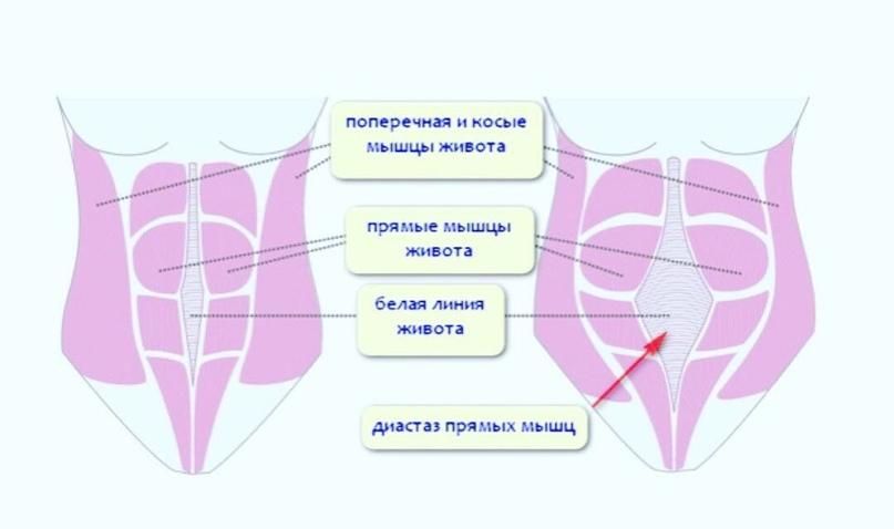 Диастаз! Закачивать нельзя оставить… Где поставим запятую?